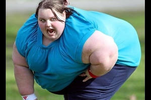 Người béo phì có nguy cơ mắc ung thư cao hơn 50%