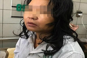 Nữ điều dưỡng nghi uống thực phẩm chức năng giảm cân ở Sơn La đã tử vong