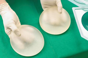 Cảnh báo thêm 1 dạng ung thư nguy hiểm do nâng ngực