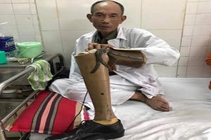 Làm rõ nhóm đối tượng hành hung thương binh sau khi va chạm giao thông Làm rõ nhóm đối tượng hành hung thương binh sau khi va chạm giao thông