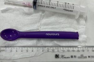 Say rượu, cô gái nuốt chiếc thìa nhựa 15cm vào bụng