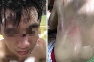 Cận cảnh Clip đội bóng xăm trổ đánh hội đồng đối phương sau khi thua trận