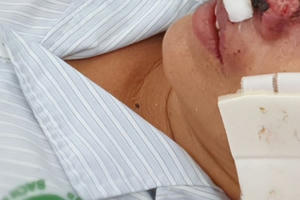 Sắp diễn ra Hội thảo Khoa học bệnh Whitmore toàn cầu lần thứ 9