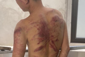 “Nữ quái” cho vay nặng lãi “tra tấn” con nợ bằng dây điện