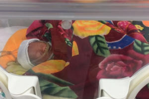 Bé gái nặng 800g chào đời một cách đặc biệt vào đúng ngày Lễ tình yêu