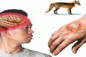 Hòa Bình: Gia đình 4 người bị chó cắn, 2 bố con tử vong Hòa Bình: Gia đình 4 người bị chó cắn, 2 bố con tử vong