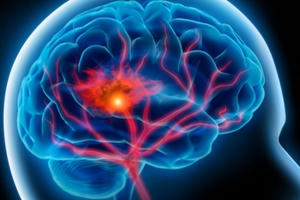 Căn bệnh khiến nghệ sĩ Khánh Nam qua đời nguy hiểm ra sao?