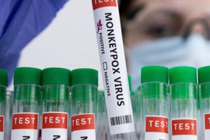 Bộ Y tế hướng dẫn các biện pháp phòng, chống tạm thời với bệnh đậu mùa khỉ