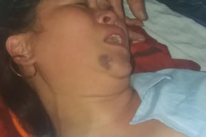 Người phụ nữ bị đánh chấn thương sọ não vì “chửi đổng” chuyện vứt rác bừa bãi