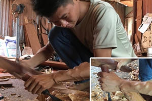 "Kịch bản lừa" tàn nhẫn của các đối tượng trong đường dây mua bán thận với hơn 40 bệnh nhân