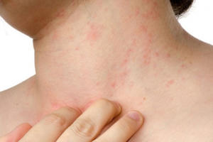 Hà Tĩnh: Tìm ra "thủ phạm" gây viêm da cho người dân tại huyện Thạch Hà