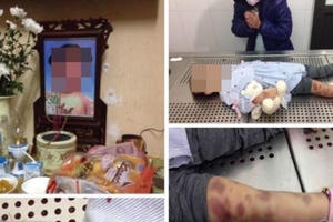 Hà Nội: Nghi án cháu bé 3 tuổi bị cha dượng và mẹ đẻ bạo hành đến tử vong
