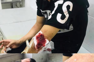 Bắt giam Trương Phú Hồng, kẻ kích động vụ hỗn chiến ở biển Hải Tiến