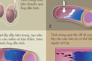 Phát minh kỳ diệu: Loại thuốc giúp đàn ông tránh thai trong 2 năm