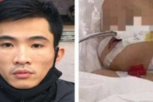 Vụ bé gái bị ghim 9 chiếc đinh vào đầu: Nghi phạm đối diện nhiều tội danh, người mẹ có vô can?