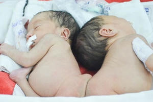 Thông tin mới nhất về hai bé song sinh dính liền mông, không có hậu môn