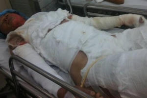 Vụ chồng thiêu sống vợ vì 50 ngàn: Luật sư cho rằng “Hành vi người chồng đã cấu thành tội giết người”