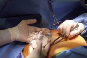 Tước giấy phép hoạt động Thẩm mỹ viện FA+