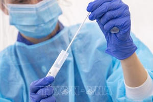 Thụy Điển phát hiện 3.700 ca có kết quả dương tính sai do bộ xét nghiệm bị lỗi