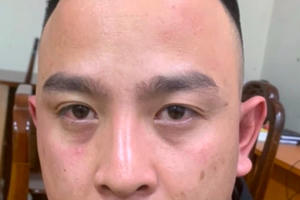 Tạm giữ nam thanh niên lái xe taxi đi cướp tiệm vàng