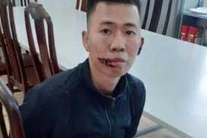 Giám định tâm thần thanh niên chém bố mẹ thương vong ở Hà Nội