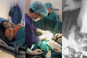 Chủ quan cơn đau bụng đẻ, thai phụ 30 tuổi mất con trai 3,6kg