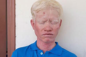 Anh trai đâm chết em vì bị trêu chọc mái tóc