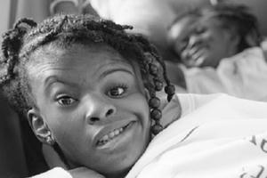 Y học cũng phải "ngã ngũ"  trước sức sống phi thường của cặp song sinh dính đầu