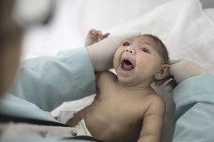 Châu Âu phát hiện em bé đầu tiên bị dị tật do nhiễm virus Zika Châu Âu phát hiện em bé đầu tiên bị dị tật do nhiễm virus Zika