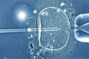 Quy định về sinh con bằng kỹ thuật hỗ trợ sinh sản và điều kiện mang thai hộ vì mục đích nhân đạo