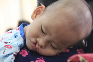 “Tìm lại nụ cười” cho trẻ hơn 100 trẻ hở hàm ếch có hoàn cảnh khó khăn