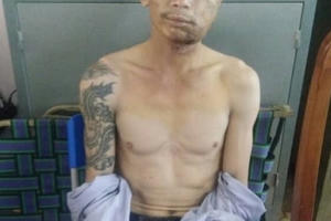 Tóm gọn đối tượng dùng súng AK nã đạn vào người tình rồi tự sát