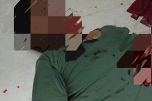 Bắc Giang: Nam thanh niên gây thương tích cho bố của bạn gái vì bị ngăn cấm chuyện tình cảm