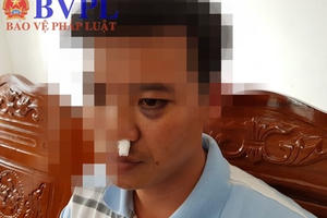 Học sinh kéo nhóm người lạ vào trường đánh thầy giáo nhập viện vì bị nhắc nhở