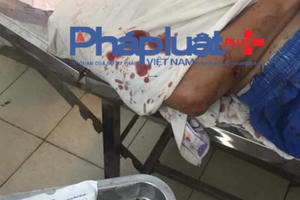 Vĩnh Phúc: Nghi án cãi lộn lúc nửa đêm, vợ cầm dao chém chồng gần chục nhát