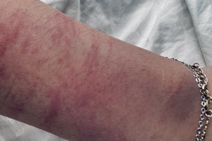 Bắt tạm giam gã bác sĩ đồi bại xâm hại bệnh nhân đến khám thai