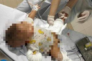 Dùng “bom xăng” ném vào nhà dân, 3 người bị thương