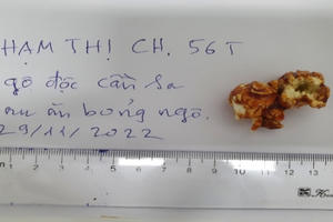 Một phụ nữ bị ngộ độc cần sa nghi do ăn bỏng ngô mua trên mạng