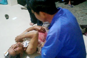 Cản 'cát tặc', người dân bị đuổi chém trọng thương