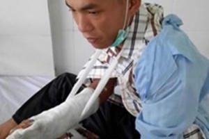 Làm rõ vụ cán bộ bảo vệ rừng bị chém trọng thương