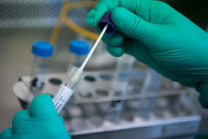 Không được lợi dụng tình hình dịch bệnh để tăng giá dịch vụ xét nghiệm COVID-19