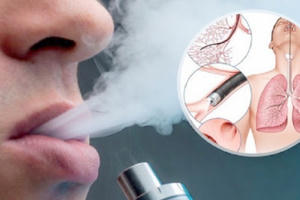 Thuốc lá điện tử: Xử lý nghiêm các trường hợp kinh doanh Thuốc lá điện tử: Xử lý nghiêm các trường hợp kinh doanh