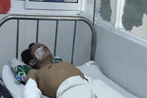 Quảng Nam: 4 công nhân nhập viện sau vụ nổ thiết bị nhà máy gạch