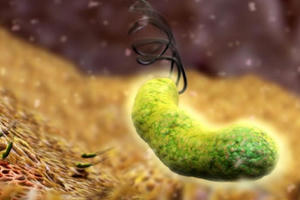 Cứ 10 người có 7 nguy cơ bị ung thư dạ dày