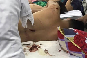 Hà Tĩnh: Bắt giữ nhiều đối tượng bịt mặt chém gục một nam thanh niên