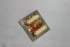 2 viên thuốc còn nguyên vỉ "đi lạc" vào thực quản người đàn ông 65 tuổi