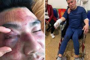 Yên Bái: Bị hành hung vì giao hàng mà không “hỏi ý kiến”?