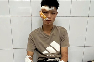 Hai đối tượng "thông chốt" tông bị thương cán bộ Cảnh sát có thể đối mặt với khung hình phạt cao nhất