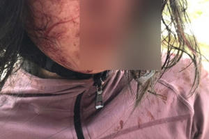 Đi làm thủ tục ly hôn, người vợ bất ngờ bị chồng rạch mặt