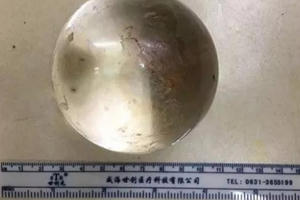Nhét quả bóng 7cm vào hậu môn, không tài nào lấy ra được